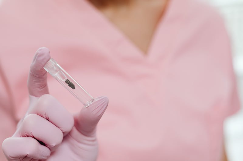 All-on-X procedure