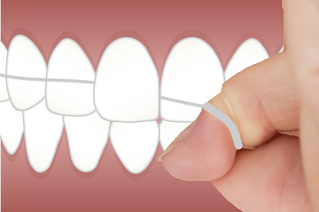 Make Time To Floss Every Day – Here’s How [Diagram]