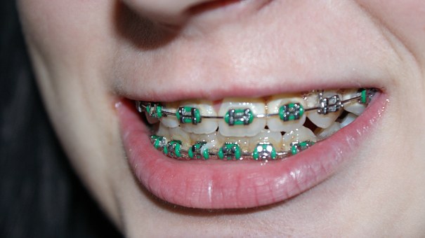 Brace Yourself: Orthodontics Maintenance Guide