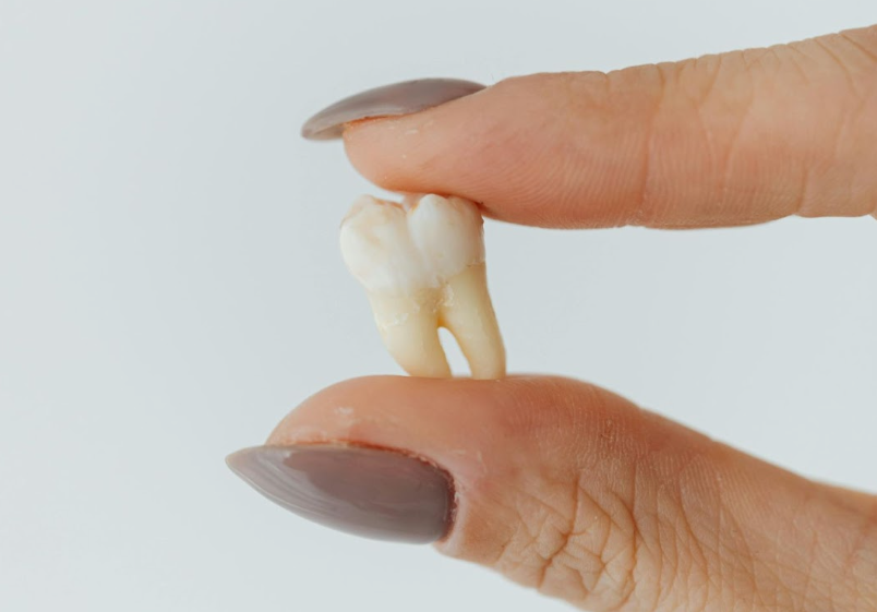 Knocked-Out Tooth? Here’s What to Do Right Away