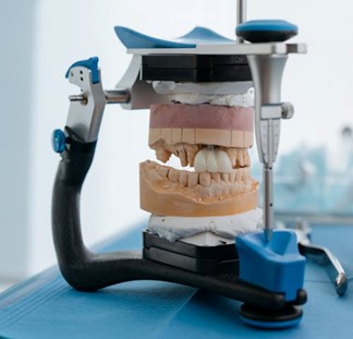 Dental implants for restoring smiles, improving function, and boosting long-term confidence.
